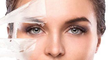 Winter Laser Skin Treatments
