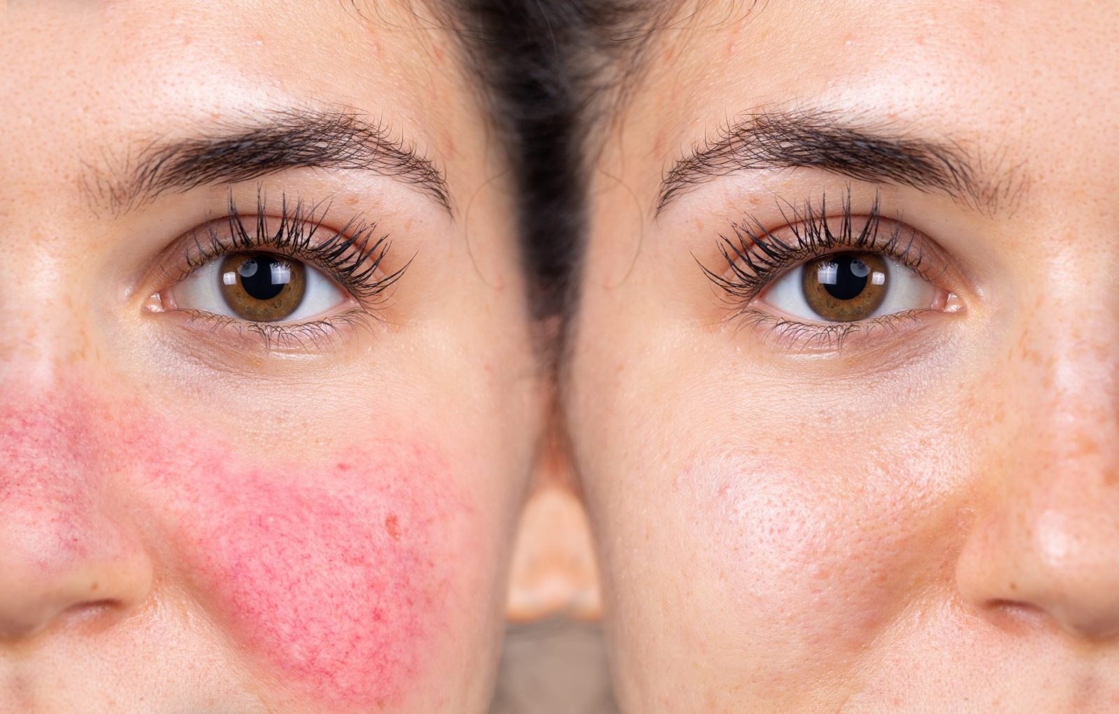 glowing-skin-header-bg