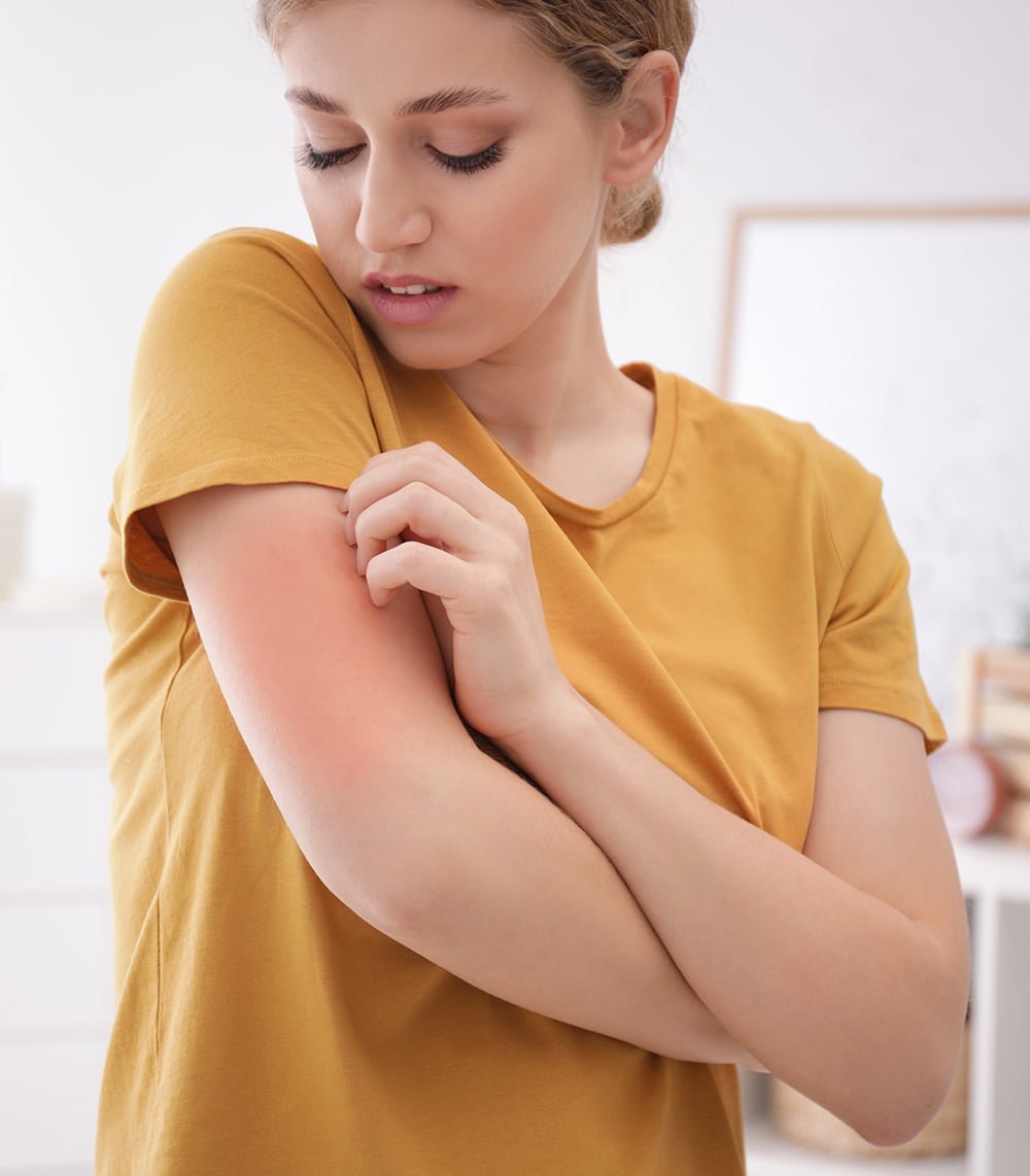 what-is-atopic-dermatitis-img Atopic Dermatitis Treatment in Wilmington