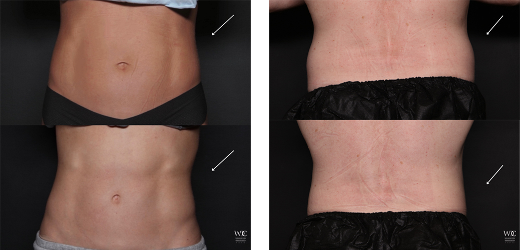 Top Combination of Injectables Therapies